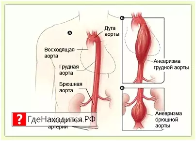 Где Находится Аорта У Человека Фото